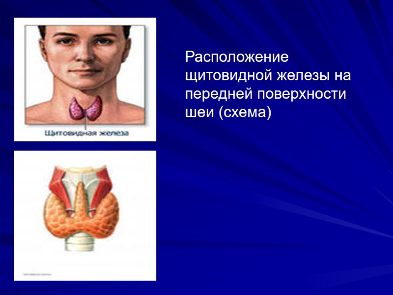 Расположение щитовидной железы на передней поверхности шеи (схема)